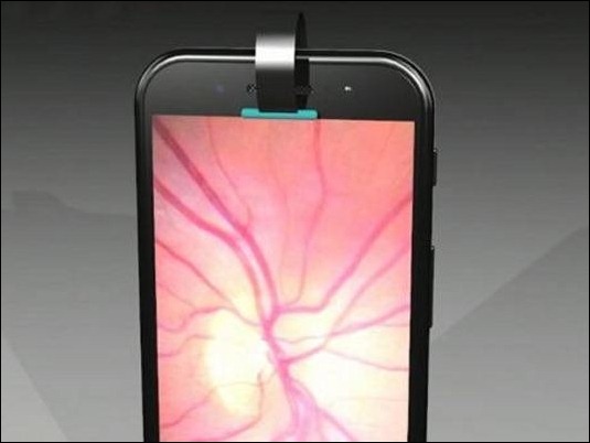 "Peek Retina", el accesorio para smartphones que diagnostica enfermedades oculares